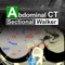 Abdominal CT Sectiona...