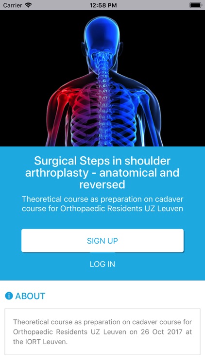 IORT - Shoulder Arthroplasty