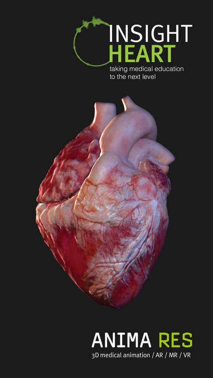 INSIGHT HEART screenshot-6