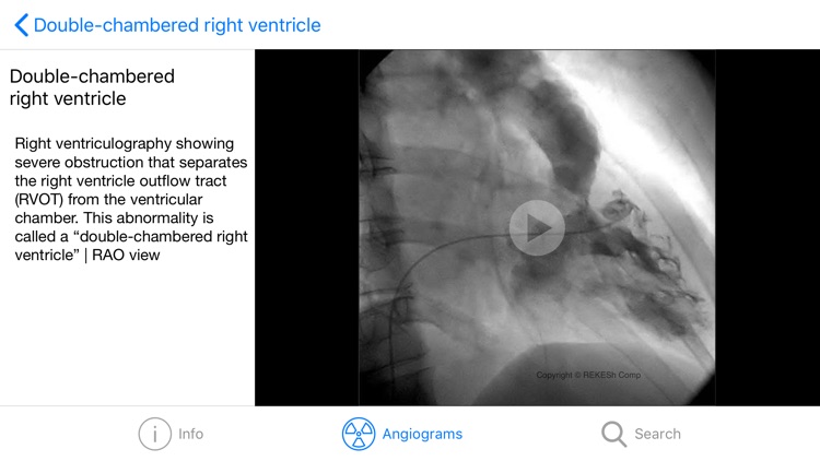 CARDIO3® Interventional Atlas screenshot-5