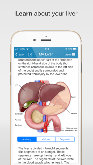 My Liver(圖2)-速報App