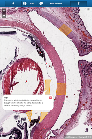 Smart Histology screenshot 3