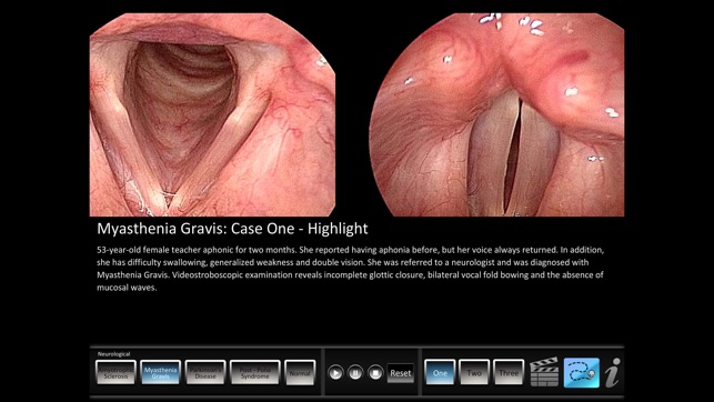 Vocal Pathology: Neurological(圖1)-速報App