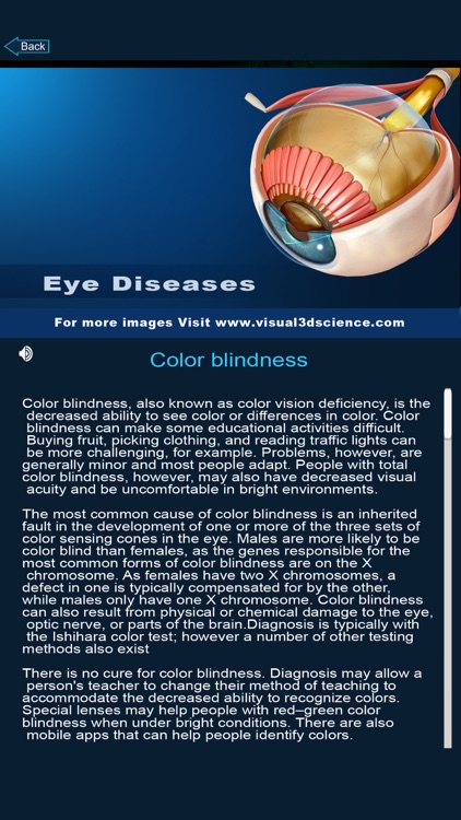 My Eye Anatomy screenshot-3