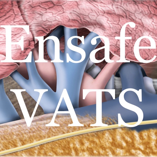 Ensafe VATS