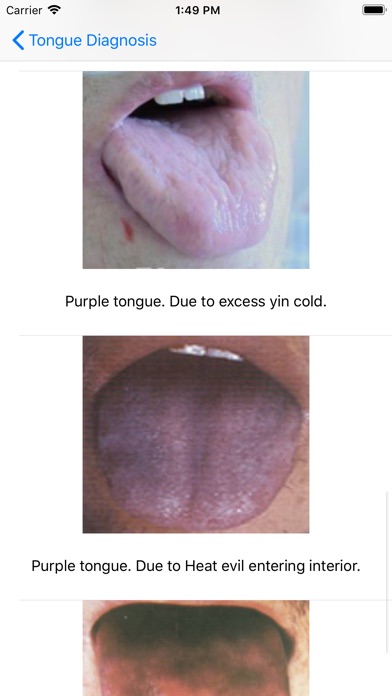 Tongue Diagnosis screenshot 4