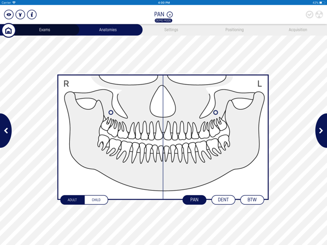 Castellini Remote Panel(圖3)-速報App