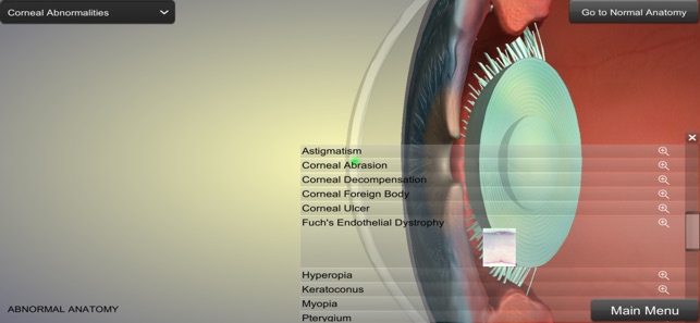 Eye Anatomy(圖3)-速報App