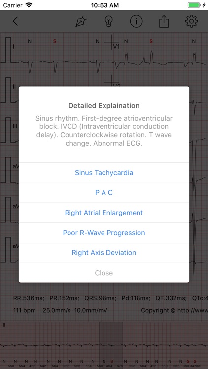 ECG Pro - Cases for CME & EMT screenshot-3