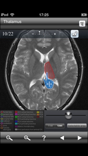 Brain MRI Sectional Walker(圖2)-速報App