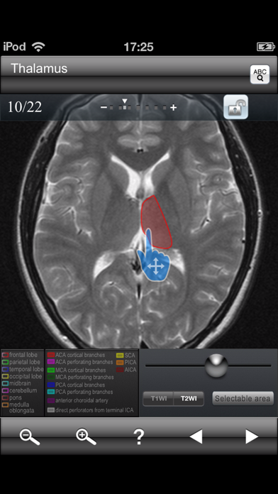 Brain MRI Sectional Walker Screenshot 2