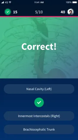 Game screenshot Quiz Anatomy hack