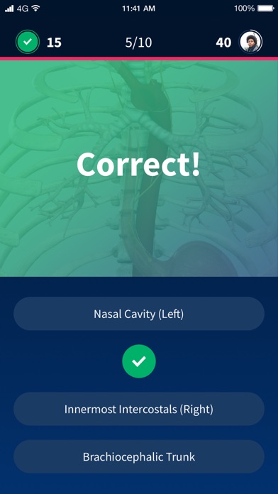 Quiz Anatomy screenshot 3