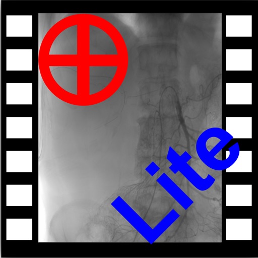iMedViewer-Lite
