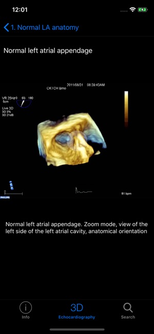 CARDIO3® 3D Echocardiography(圖3)-速報App