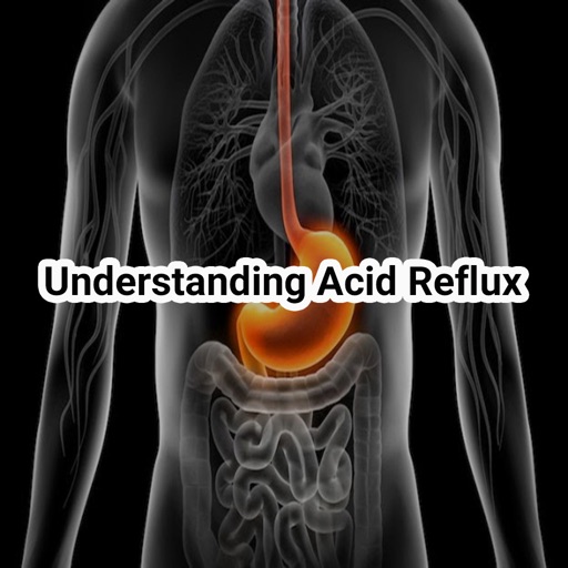 Understanding Acid Reflux