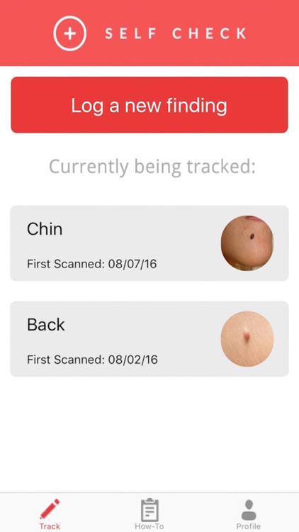 SelfCheck - Skin Cancer Prevention