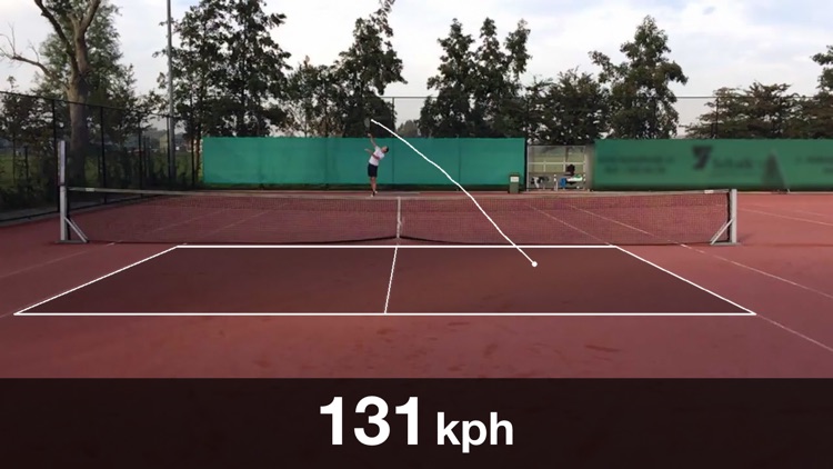 Serve Scope