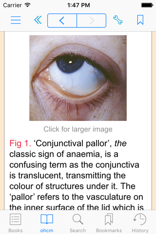 Oxford Handbook of Clinical Medicine,Ninth Edition screenshot 3