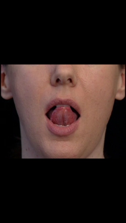 SmallTalk Oral Motor Exercises screenshot-3