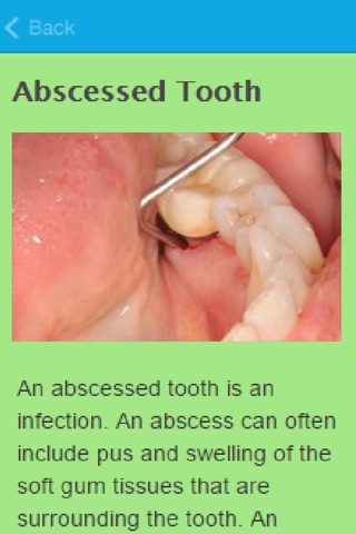 How To Treat An Abscess screenshot 2