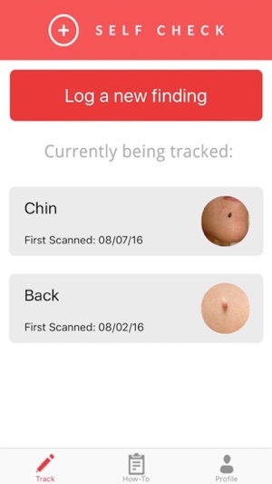 SelfCheck - Skin Cancer Prevention(圖3)-速報App