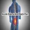 Acute Edema and Back Pain