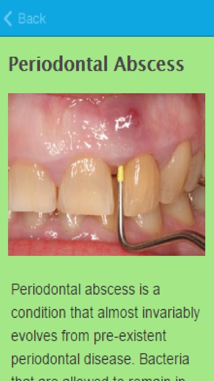 How To Treat An Abscess