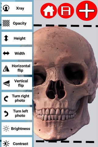 Xray Photo Creatorのおすすめ画像1