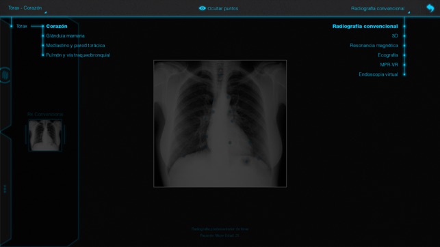 Atlas interactivo de anatomía radiológica(圖3)-速報App