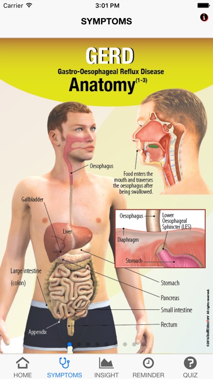 Signs & Symptoms GERD