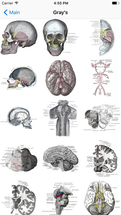 Brain Images screenshot-3