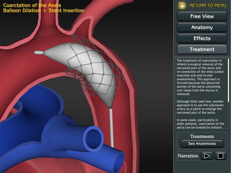 3D Road Map to Congenital Heart Disease