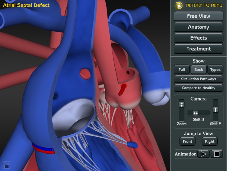 3D Road Map to ASD & VSD