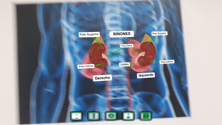 Kidneyarus