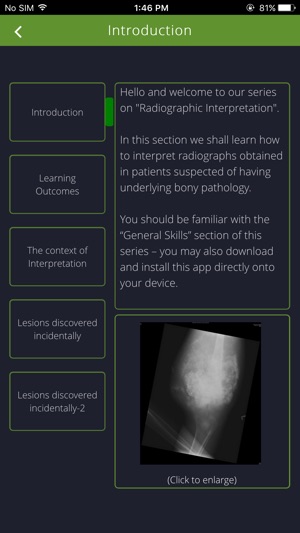 Bone Lesions(圖2)-速報App