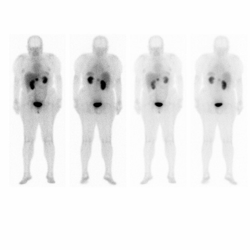 Nuclear Medicine Flashcards icon