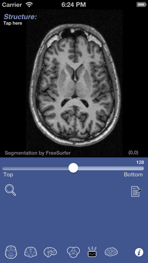 iSurf BrainView