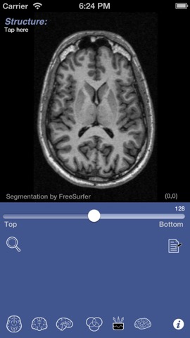 iSurf BrainViewのおすすめ画像1