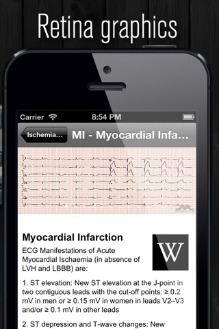 ECG Atlas screenshot 2