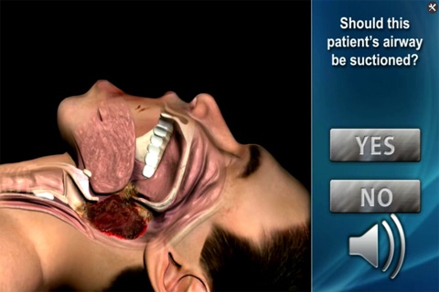 Medrills: Suctioning Airway screenshot 2