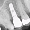 Dental Radiographs