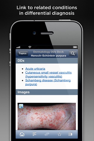 Dermatology DDx screenshot 4