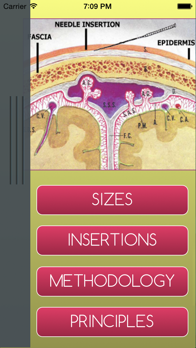 Scalp Acupuncture Reference Screenshot 2