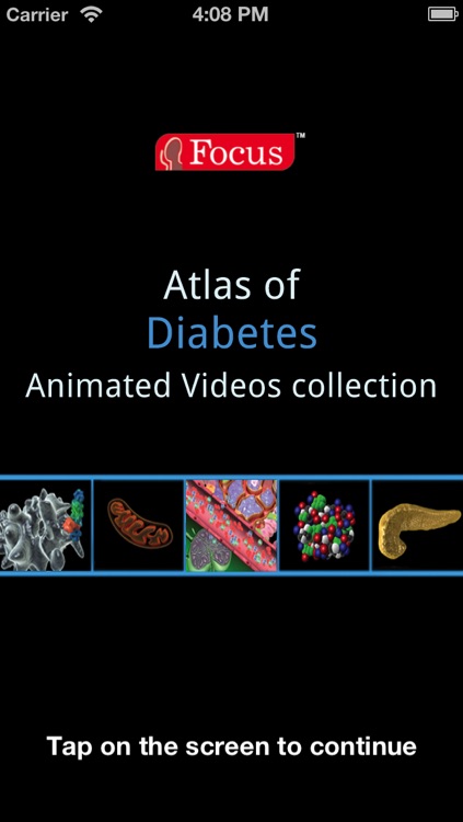 Animated Atlas of Diabetes