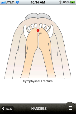 Small Animal Fracture Management screenshot 4