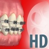 Dentapedia HD (Orthodontics)