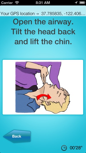 CPR Assistant ©(圖3)-速報App