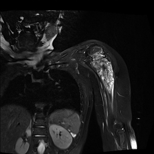 Pediatric Radiology Flashcards