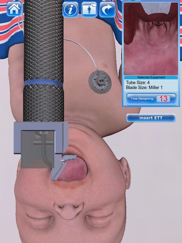 Infant Endotracheal Intubation screenshot 4
